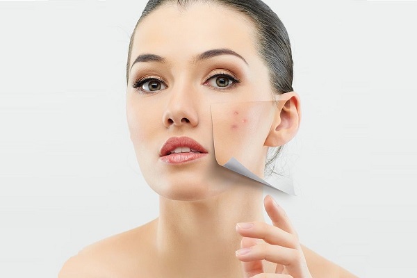DA DẦU MỤN, NHẠY CẢM NÊN DÙNG SỮA RỬA MẶT NÀO?