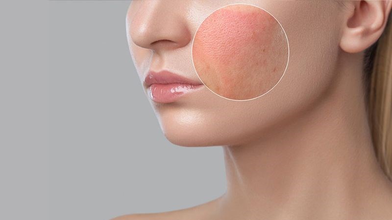 Da bị kích ứng có tự hết không?