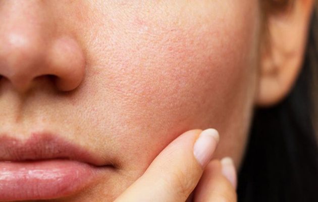 Những dấu hiệu của một làn da lão hoá