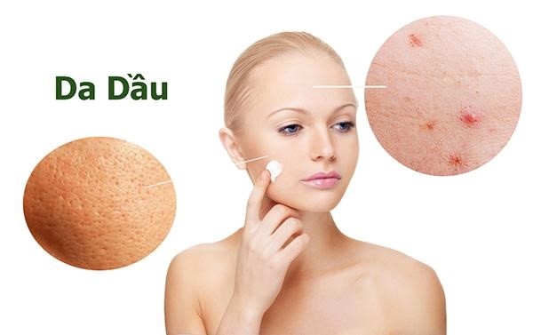 Da nhờn thường có lỗ chân lông to và dễ nổi mụn