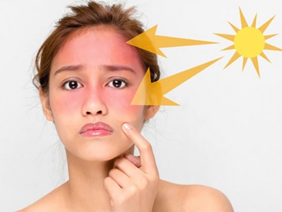 Tia cực tím từ ánh nắng mặt trời gây lão hóa da