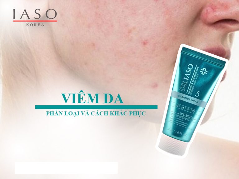 Viêm Da – Phân Loại và Cách Khắc Phục