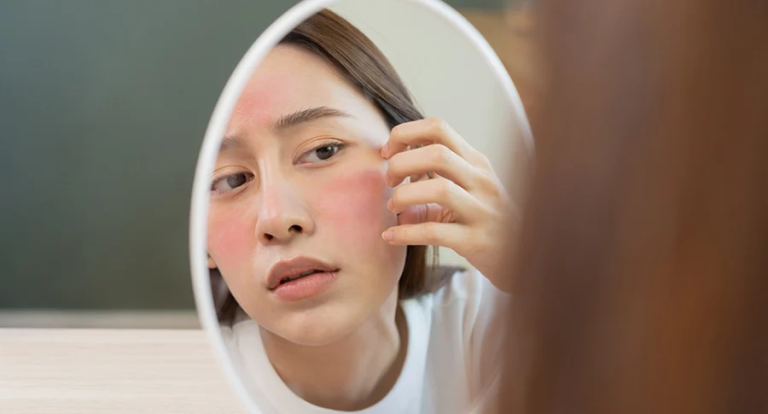 Nguyên Nhân Khiến Da Nhạy Cảm Và Cách Chăm Sóc